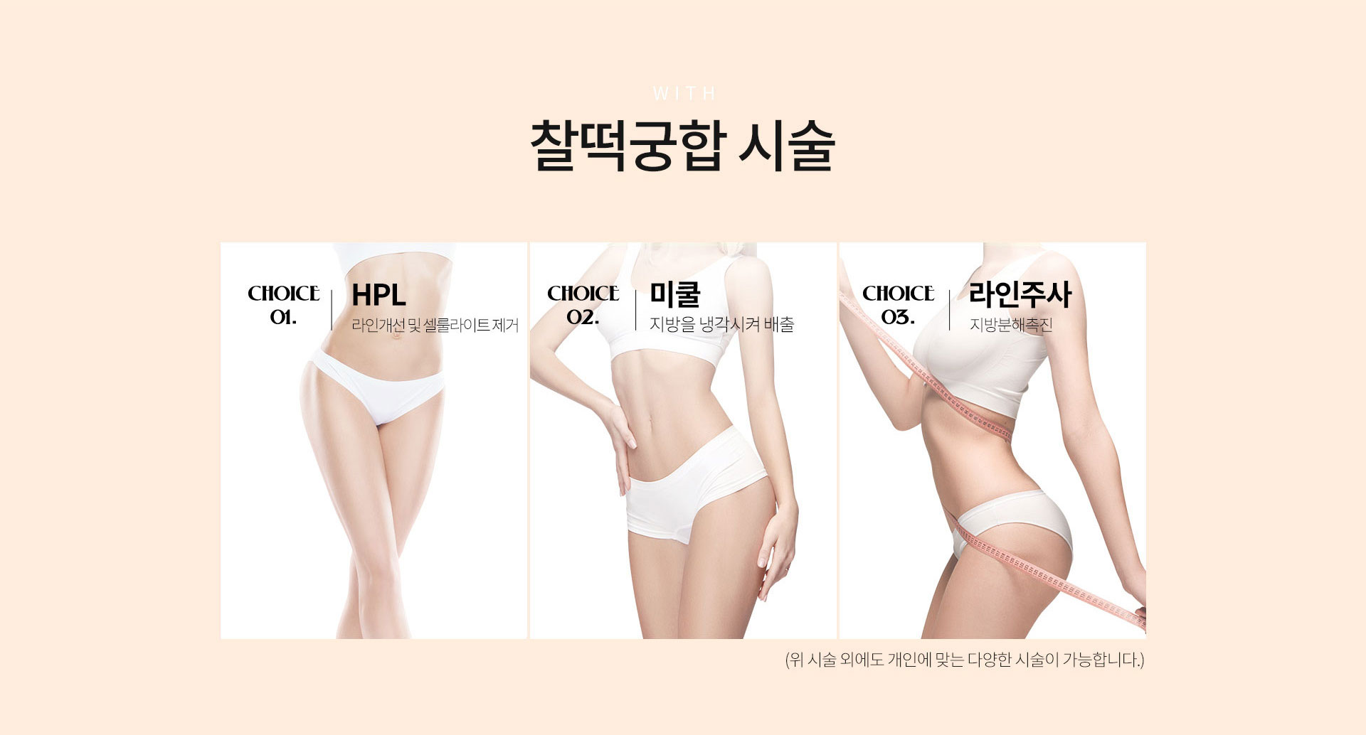 찰떡궁합시술