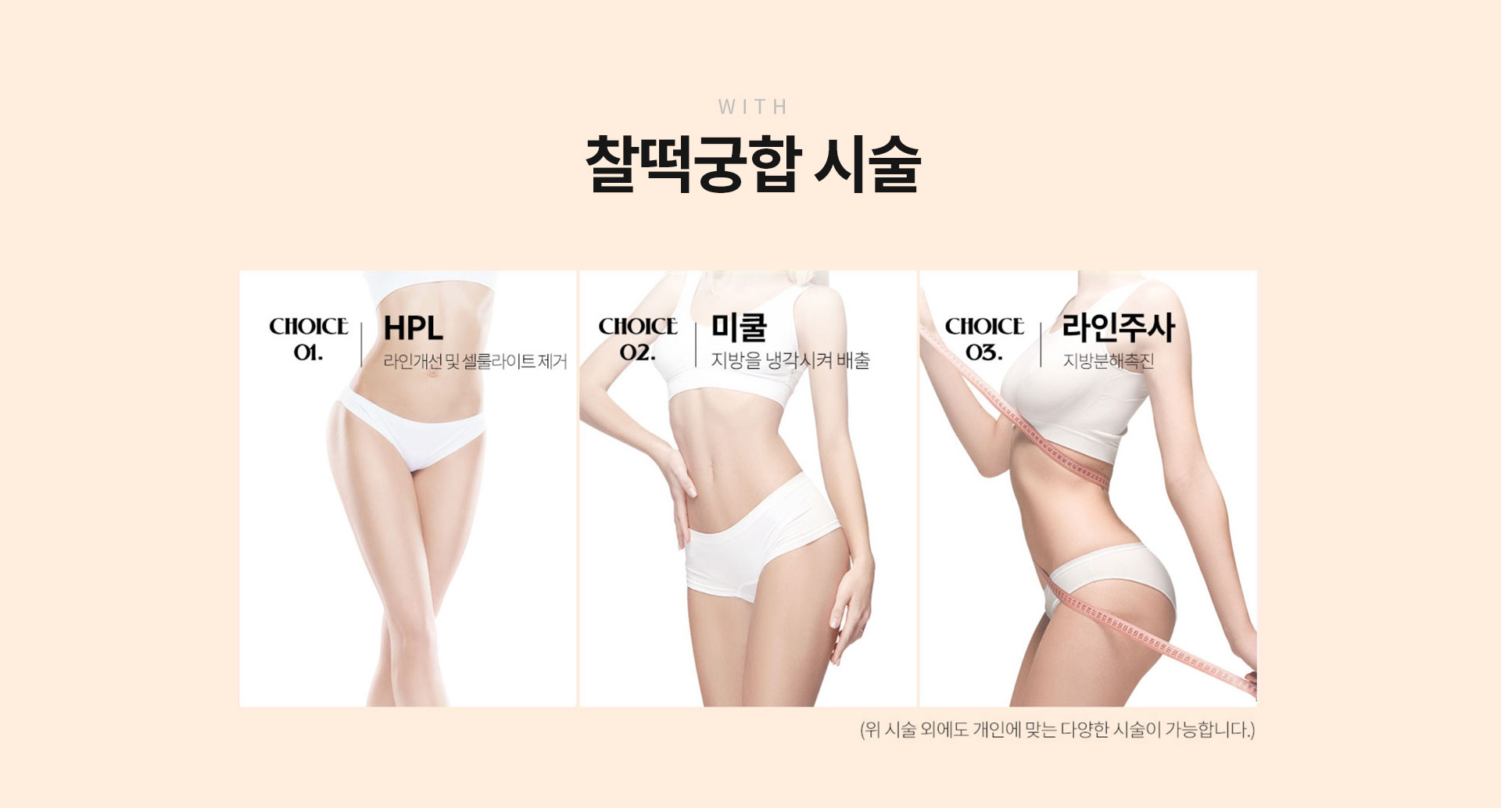 찰떡궁합시술