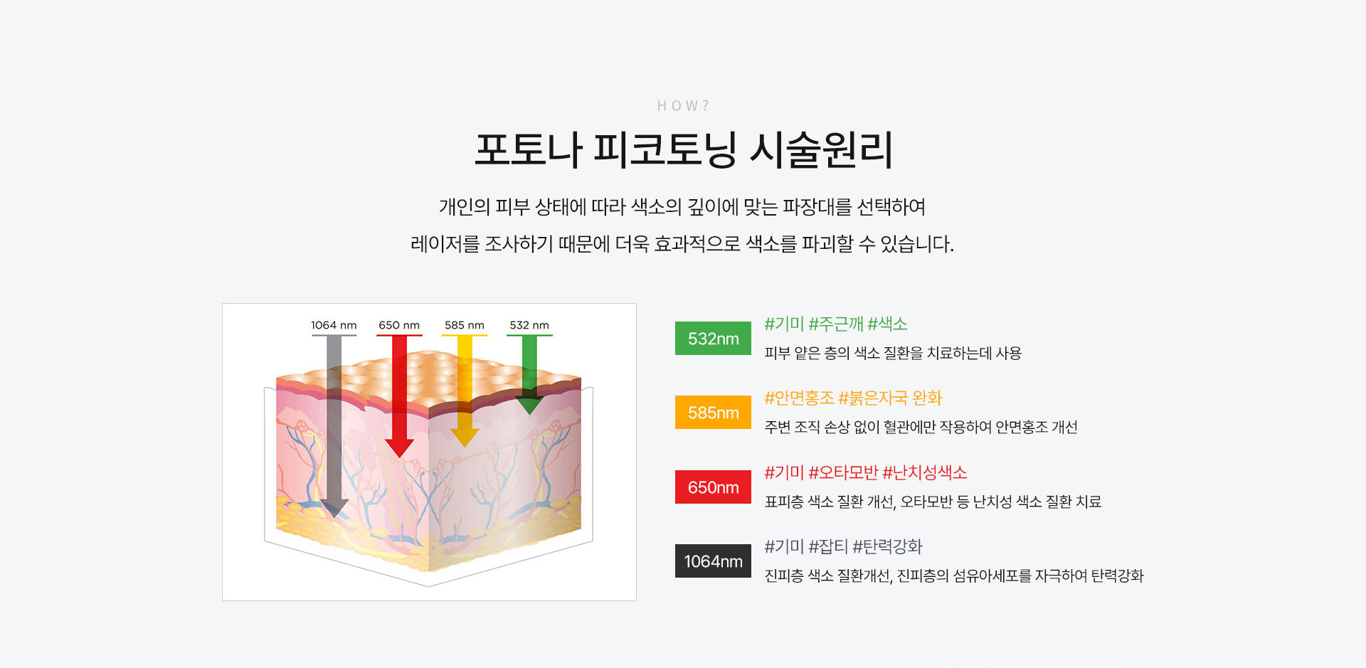 시술원리