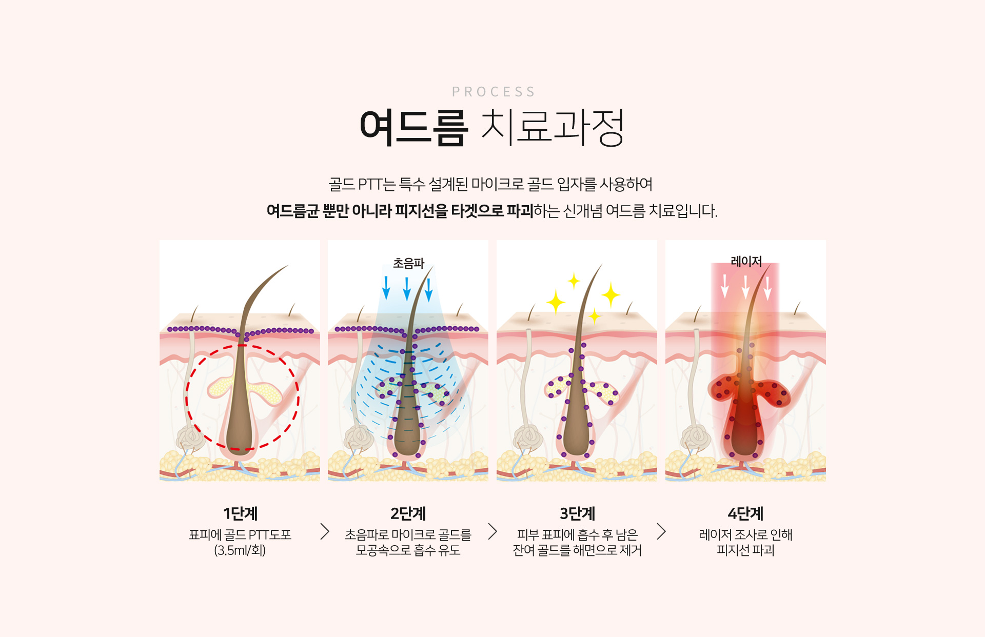 효과