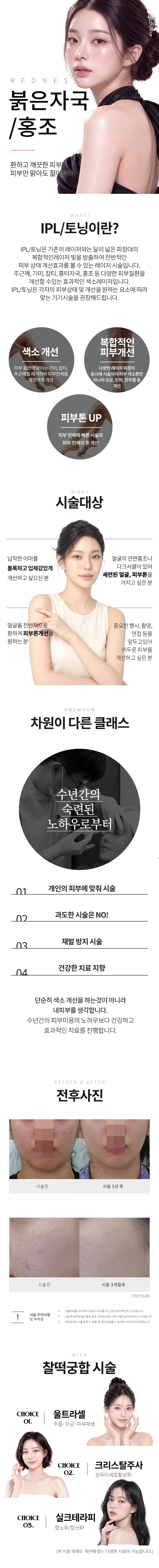 랜딩이미지